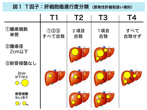 亀渕友香 死去した死因の病気 肝細胞がんはステージ４だったのか？入院から死去までの時間で予想してみた。